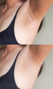 lanveza Lanveza™ IPL Laser Hair Removal Handset Review