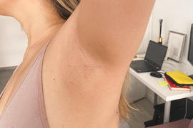 lanveza Lanveza™ IPL Laser Hair Removal Handset Review