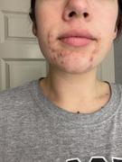 lanveza Lanveza LED Beauty Mask Review