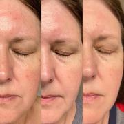 lanveza Lanveza LED Beauty Mask Review