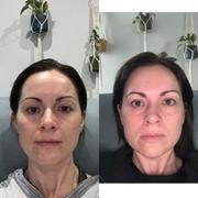 Skin O2 Skin Gym Facial Toner + Free Derma Fill Gel Review