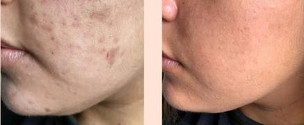Skin O2 Ultra Glow Serum + Free Peptide Mask Review