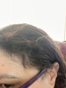 Natural Look Australia Anti-Hair Loss Concentrated Treatment Review