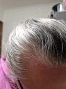 Natural Look Australia Anti-Hair Loss Treatment Pack Review