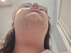 RoseSkinCo Silky Smooth Routine (Lumi + 2 Gloves + Lotion) Review