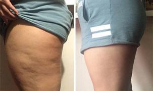 BelleGlory® Ultrasonic Cavitation Handset™ 6-in-1 Slimming & Beautifying Device Review