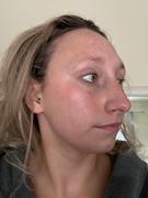 The Ayurveda Experience SkinXcell - Multi Benefit Skin Support For ALL Layers | VEGAN Collagen Booster Review