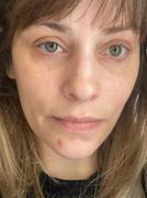 The Ayurveda Experience Cápsulas Clearizy - Potente suplemento para el acné - Control 5 en 1 | Etiqueta limpia 100 % natural | Acción rápida y duradera - Paquete de 3 Review