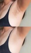 glowskinsco Lumé™ Pro IPL Laser Hair Removal Review