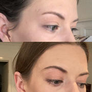 xoBeauty RevitaBROW Advanced (4 month supply 3mL) (EYEBROW Conditioner) Review