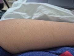 RoseSkinCo Lumi - Permanent Hair Removal Device Review