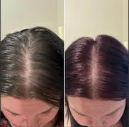 hair growth bundle