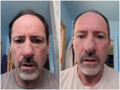 Particle Particle Face Wash Review