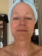 Makeup Artist’s Choice 12.5% TCA At Home Peel Review