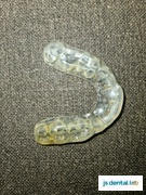 JS Dental Lab Premium 3D Night Guard | With Occlusion-Check to Enhance Comfort, Durability and Protection Review