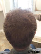 SureThik Hair Fiber Value Package (20% Savings) Review