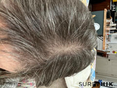 SureThik Hair Fiber Starter Package + Application Tools Review
