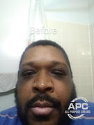 APH Hydroquinone Cream - All Purpose Creams