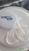 Alien Milling Technologies Snap on Smile® Review