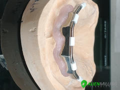 Alien Milling Technologies Alien Implant Titanium Bar Review