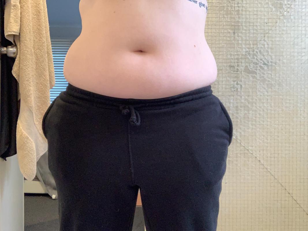 LUX SKIN® Body Sculpting Handset