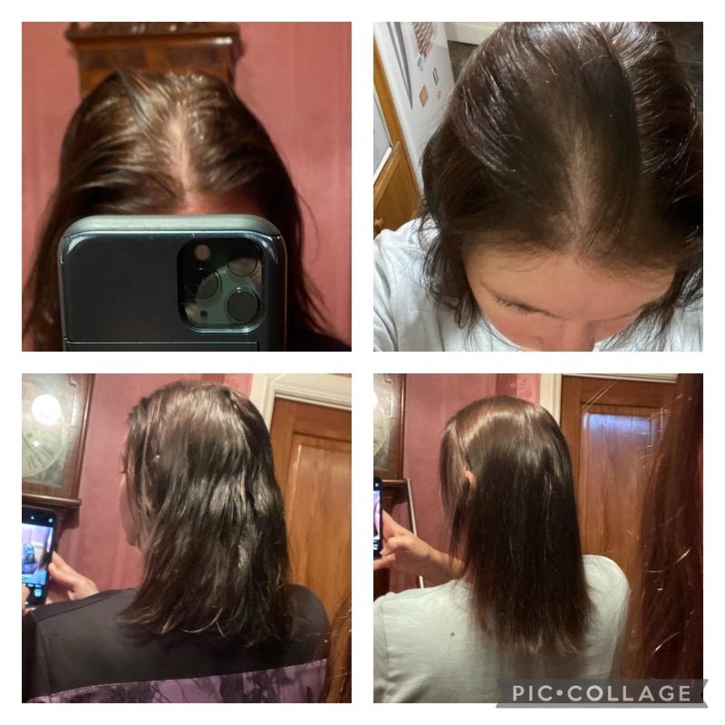 hair growth bundle – georgiemane