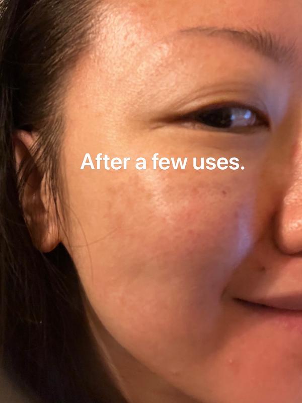 Face Contouring] Age-R Derma EMS Shot– MEDICUBE US