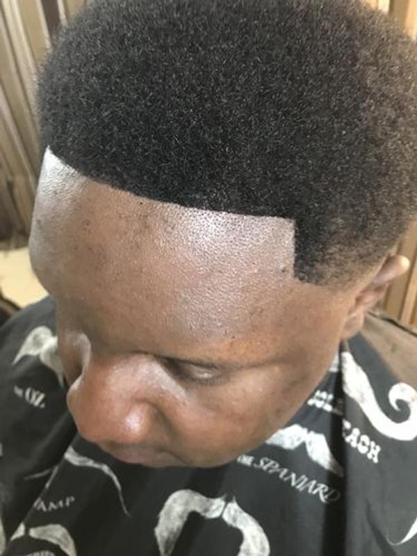 andis blade adjuster