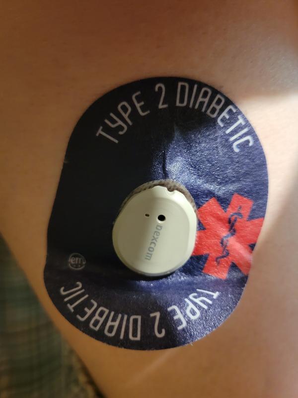 Type 2 Diabetic Alert G7 Tape ExpressionMed