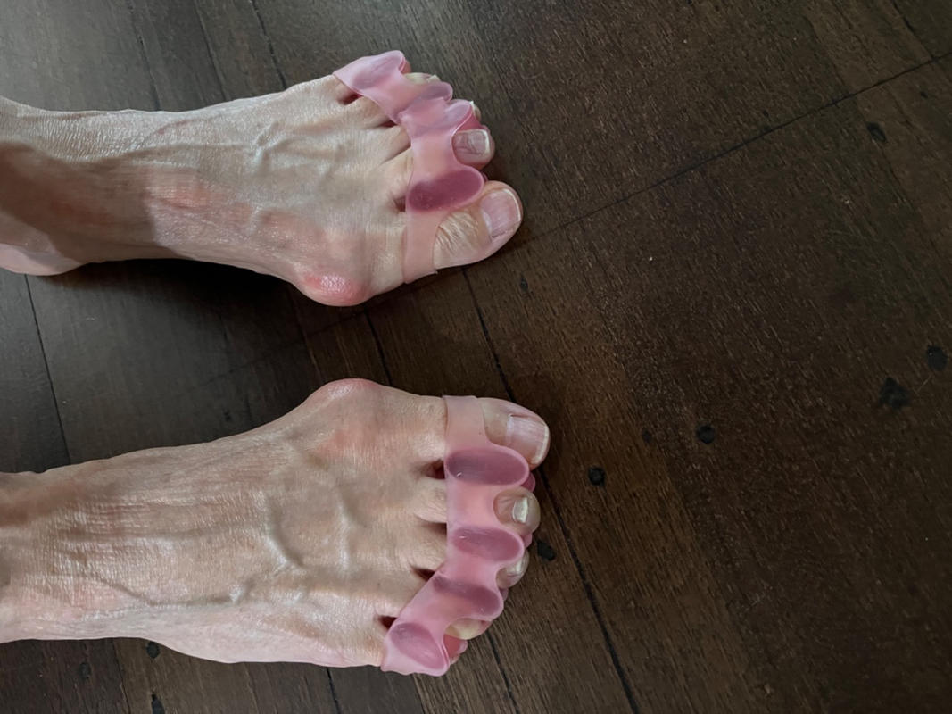 Toe Separator for Bunions, Claw Toes, Hammer Toes and foot pain relief Freestyle Feet