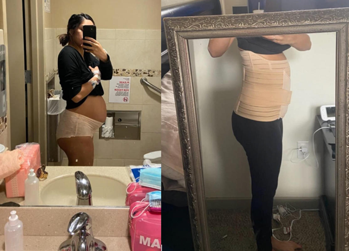 PreggoBands 3 in 1 Post Pregnancy Belly Band Preggobands