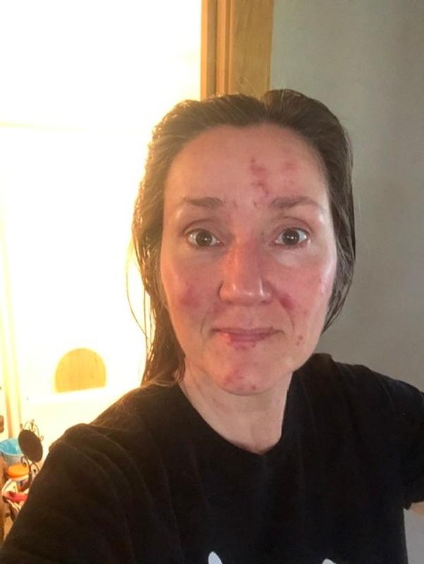 Cleansing Oil For Oily Skin + Acne Prone Skin Primally Pure