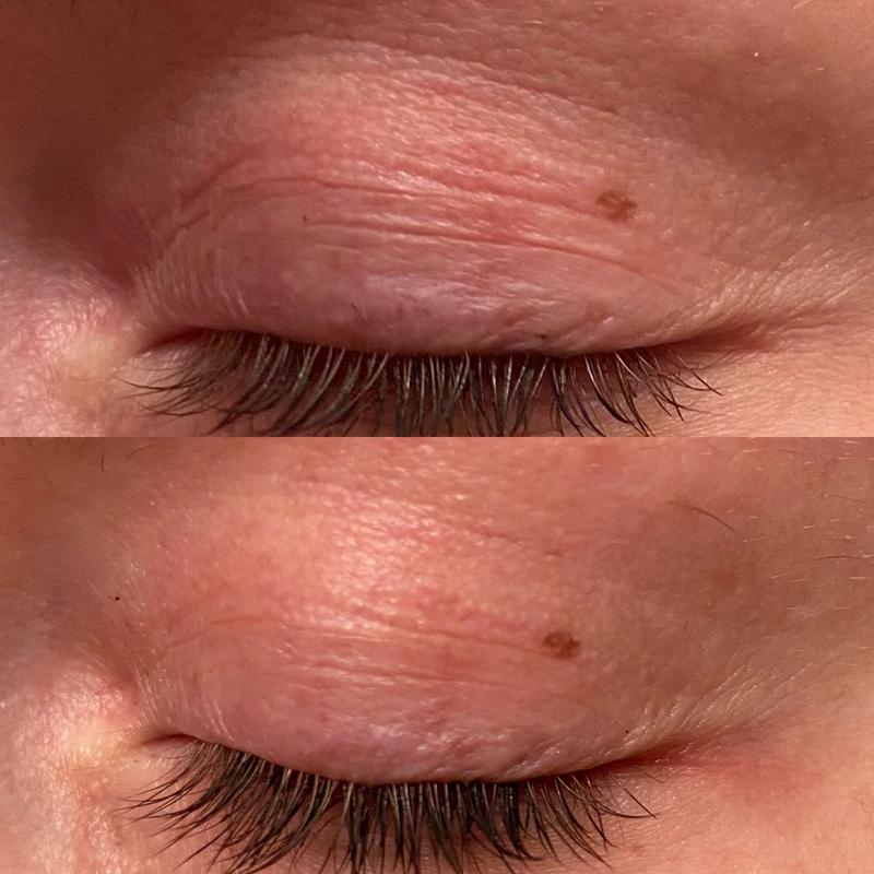 ALASTIN Skincare Restorative Eye Treatment ALASTIN Skincare®