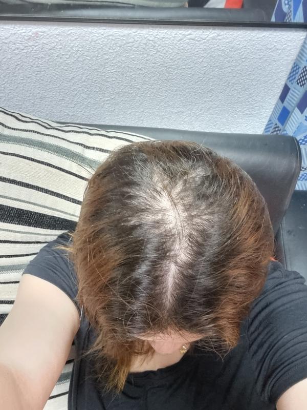 hair growth spray – georgiemane
