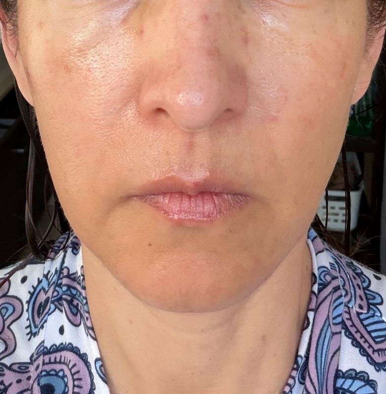 AGE-R Glutathione Glow Serum MEDICUBE US AGE-R Glutathione Glow Serum MEDICUBE US
