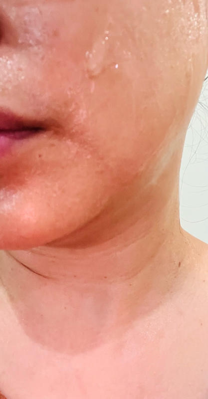 AGE-R Ussera Deep Shot (Collagen Production) – MEDICUBE MY