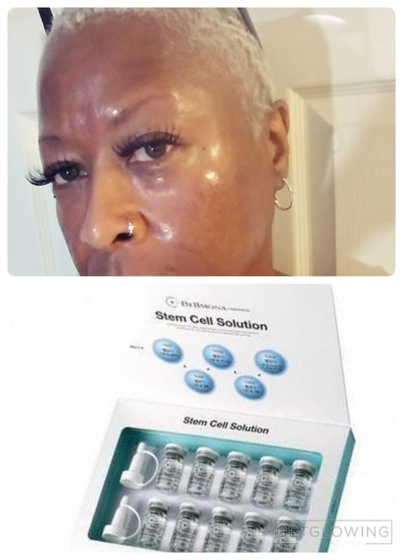 Ronas Stem Cell Solution | GetGlowing Skincare