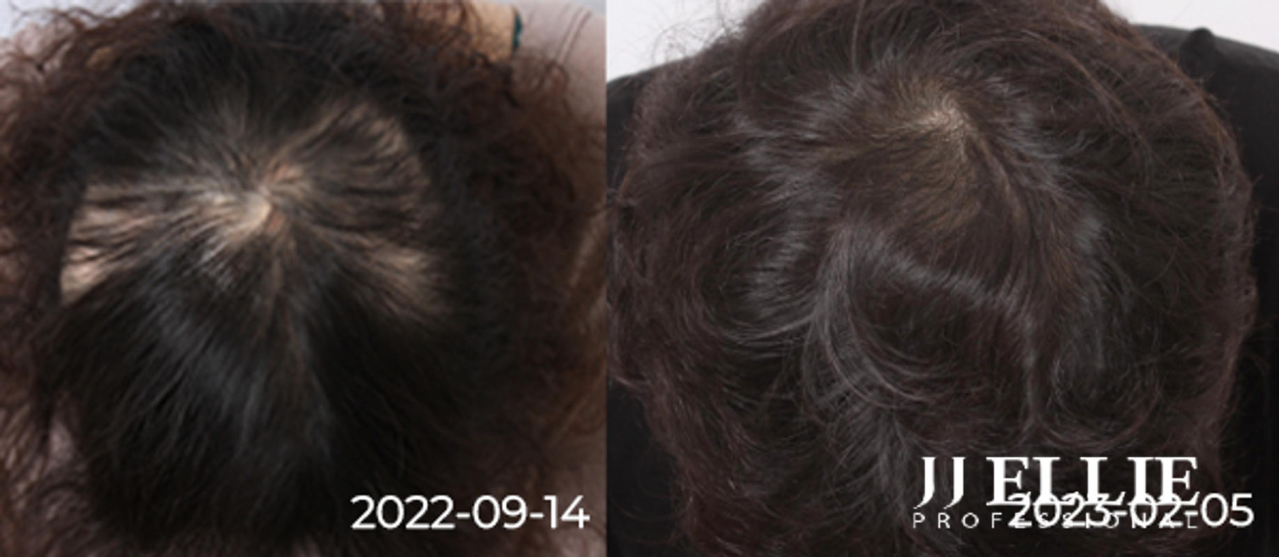 HAIR NO MORE PATCHY – JJ ELLIE SKINCARE