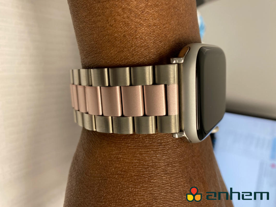 Two toned apple watch band discount