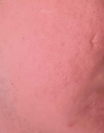aprilskin.com.sg Real Carrotene Blemish Clear Serum (Pimple Serum) Review