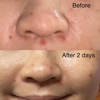 aprilskin.com.sg APRILSKIN Buffet Review