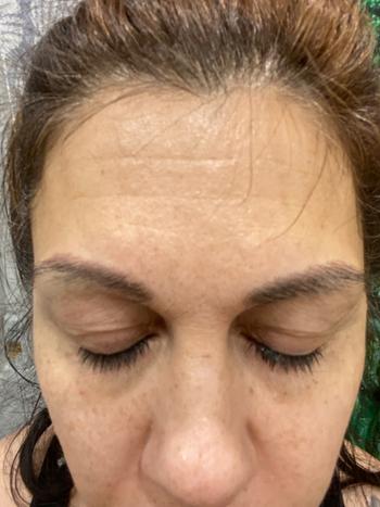 Solawave 4-in-1 Radiant Renewal Skincare Wand & Activating Serum Kit Review