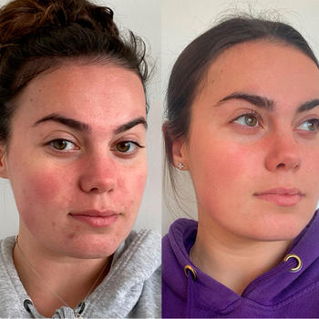 MCoBeauty SCRUB AND GLOW SKINCARE BUNDLE Review