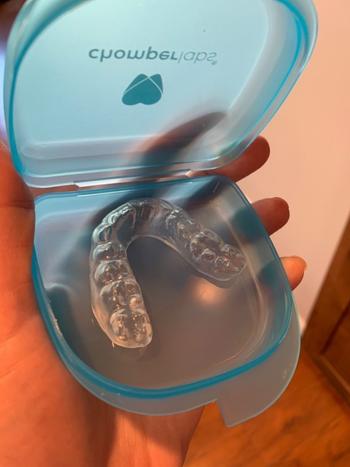 Chomper Labs The Hybrid Night Guard - for moderate to heavy teeth grinding and clenching Review