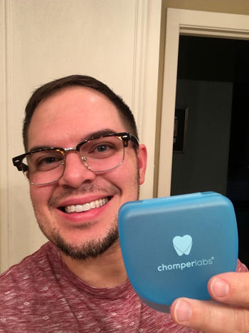 Chomper Labs The Retainer - for teeth retention and teeth grinding Review