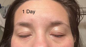The Eczema Company Organic Manuka Skin Soothing Cream by YoRo Naturals Review