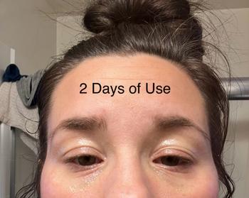 The Eczema Company Organic Manuka Skin Soothing Cream by YoRo Naturals Review