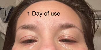 The Eczema Company Organic Manuka Skin Soothing Cream by YoRo Naturals Review