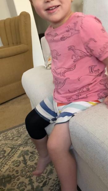 The Eczema Company Remedywear™ (TENCEL + Zinc) Sleeves/Bandages for Babies to Adults (One Pair) Review