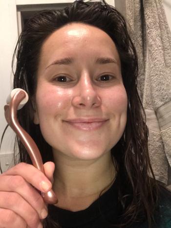 Micro Glow 0.3mm Derma Roller - The OG Review